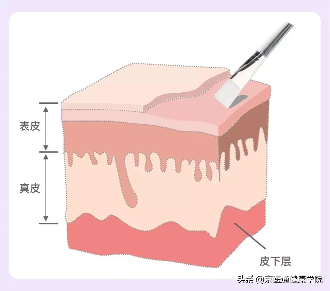 刷酸教程和注意事项,刷酸期间不要吃什么