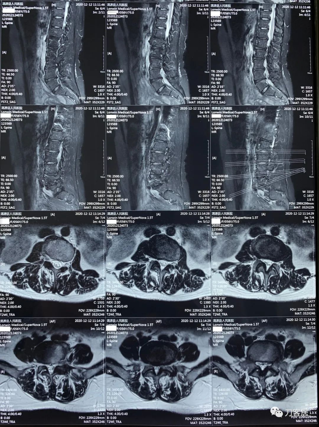 我的门诊病历,我的门诊