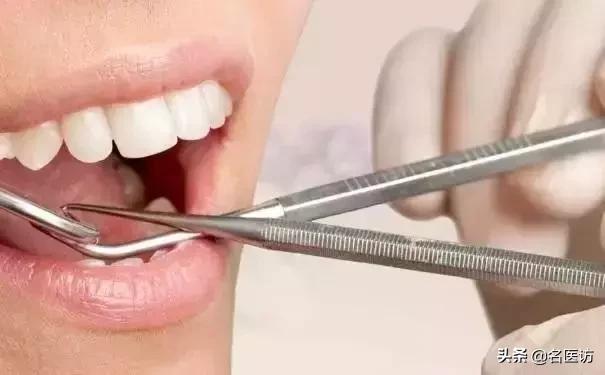 拔完牙吐口水还是咽下去,拔完智齿后可以吐口水吗