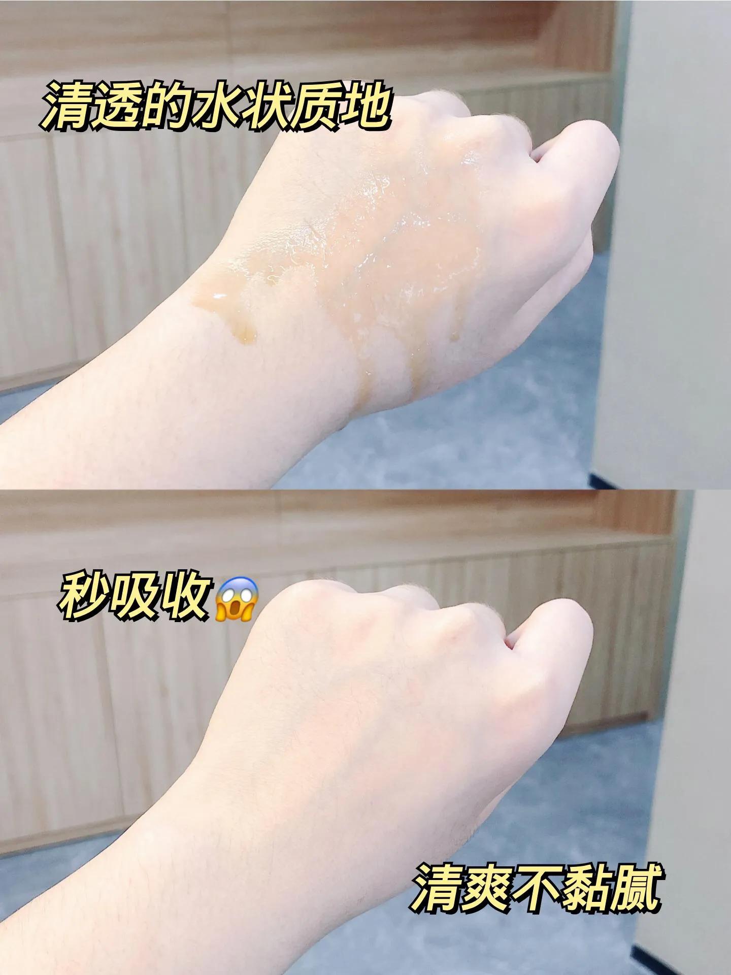 秃头拯救神器生发,防掉发育发精华液修正