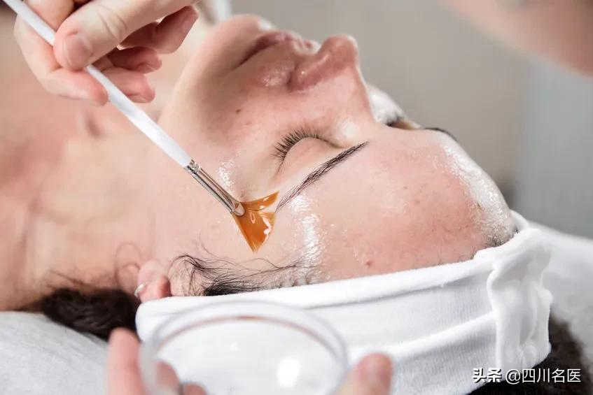 华西医院治疗痘印痘坑怎么样,四川华西皮肤科脸上长痘怎么治疗