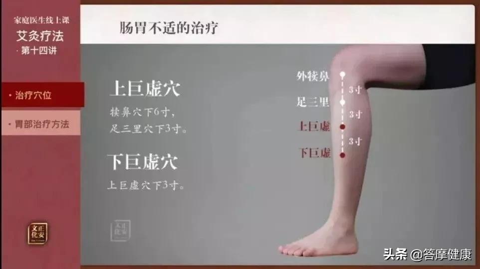 艾灸疗法调理肠胃,艾灸调理肠胃最快的方法