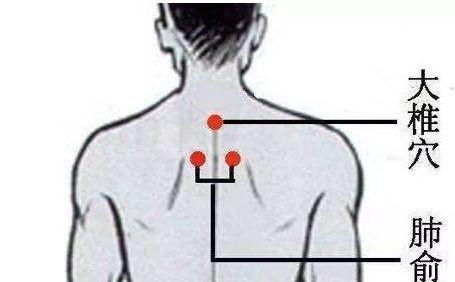 临时感冒解决办法,如果觉得自己要感冒了怎么办