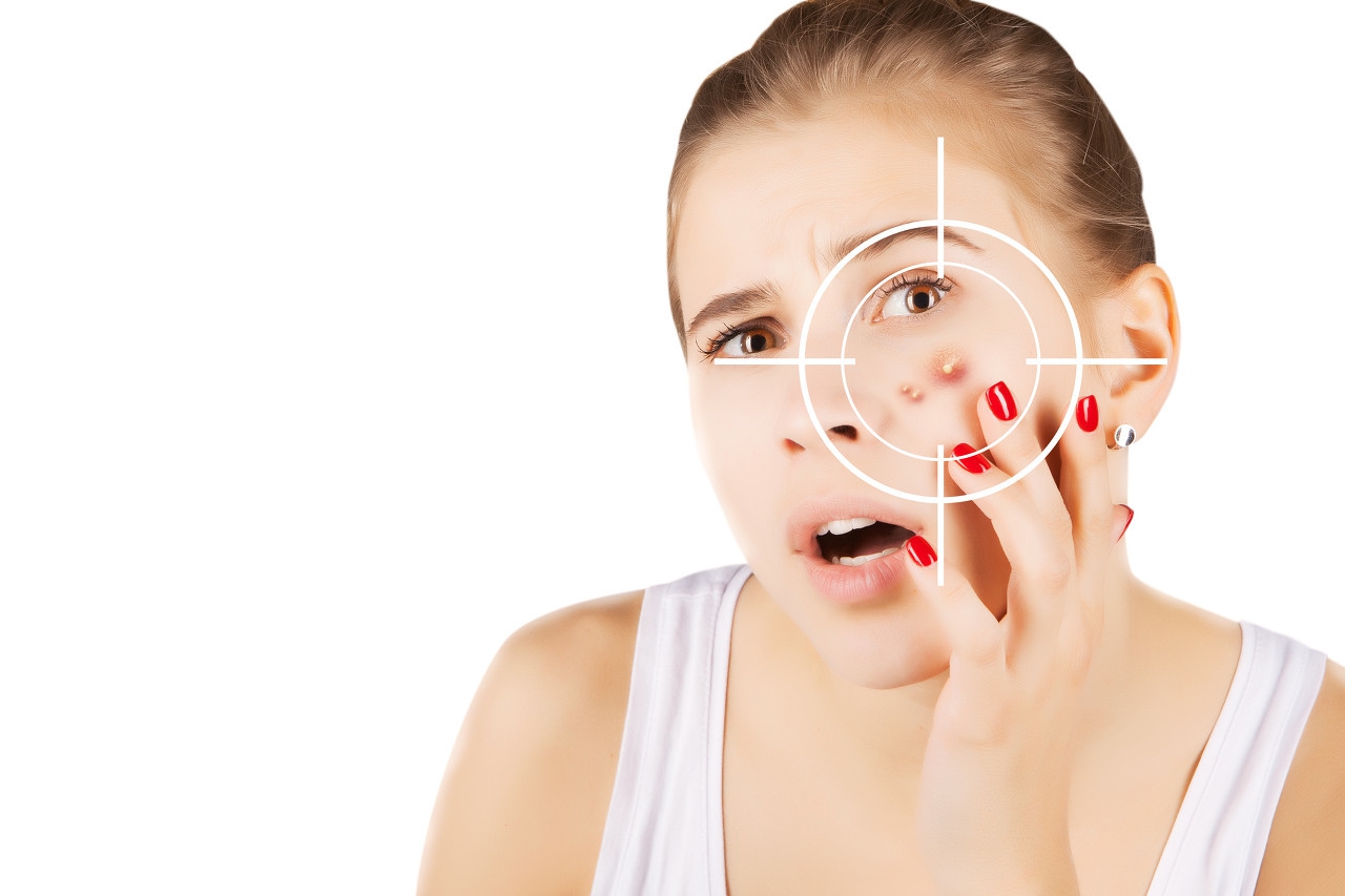 鼻子为什么会长痘痘,为什么脸上会长痘痘