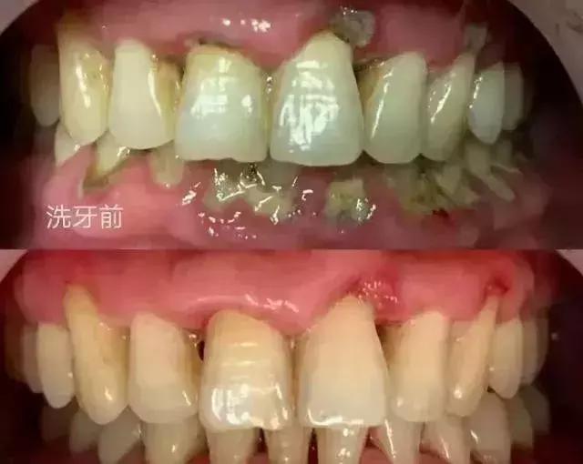 为什么总逃不过命运,为什么每个人都逃不掉命运的捉弄