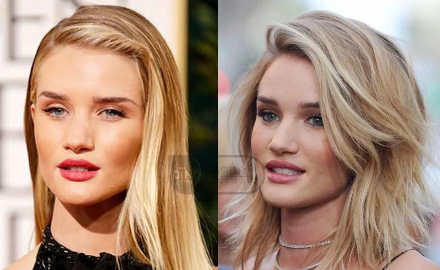 颧弓高脸型怎么改善,有泪沟可以通过调整脸型改善嘛