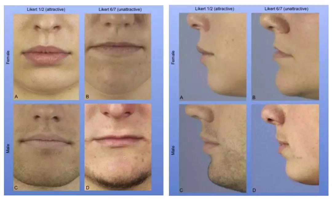 如何测试自己的嘴唇是薄还是厚,嘴唇打分