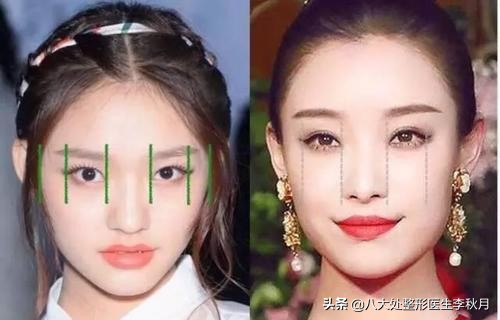 双眼皮刚做完很好看越恢复越难看,双眼皮做完感觉自己睁眼睛不自然