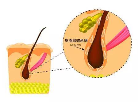 为什么出油要补水,皮肤出油多是因为缺水吗
