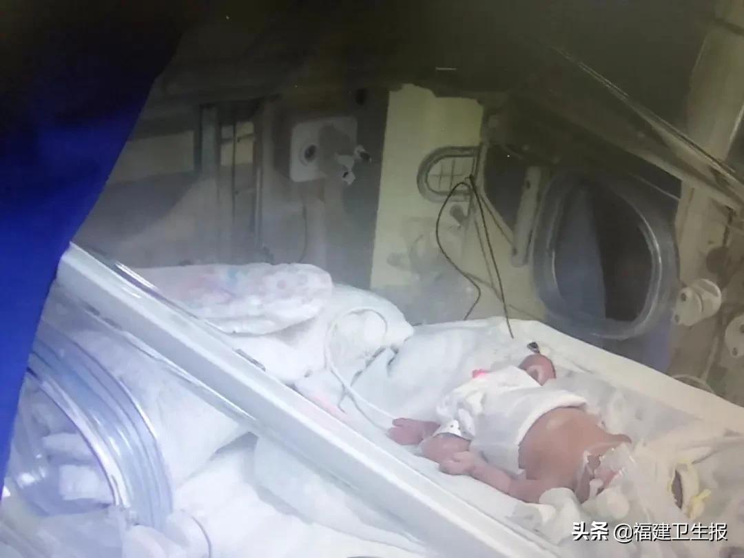 早产儿在nicu里面是怎样的,他一出生就被死神夺走一切