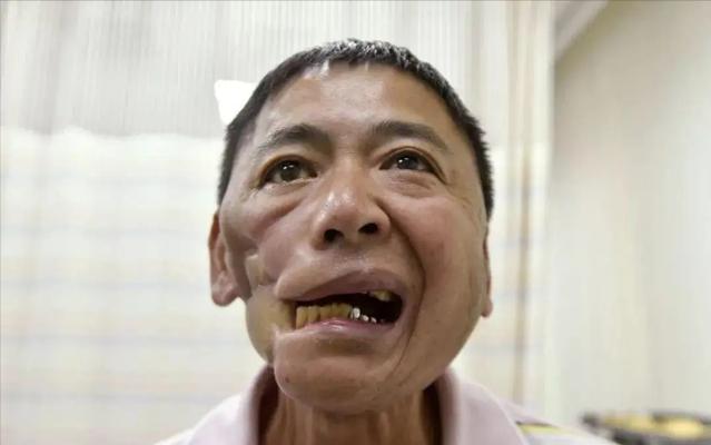 难言之隐:国际公认“软*品毒**”的槟榔,6000万国人不听劝嚼个不停