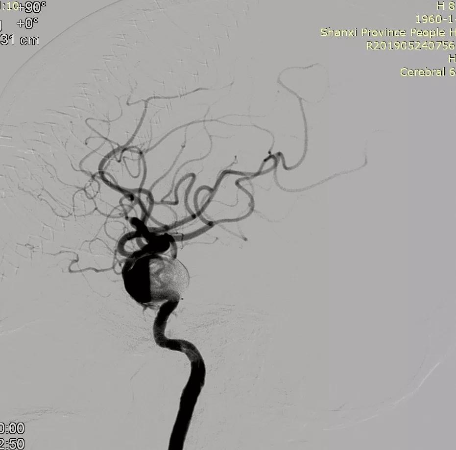 山西省人民医院任少华教授,山西省人民医院任少华