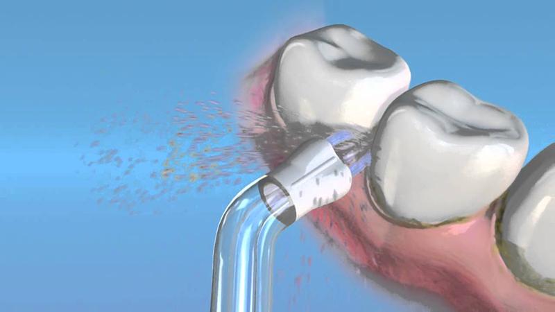 春季唇妆,唇妆不好看