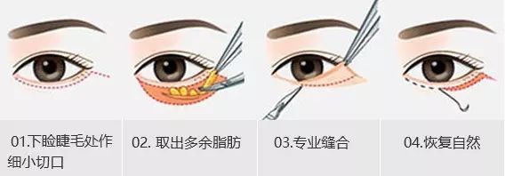 导致衰老的是哪个器官,导致衰老的原因