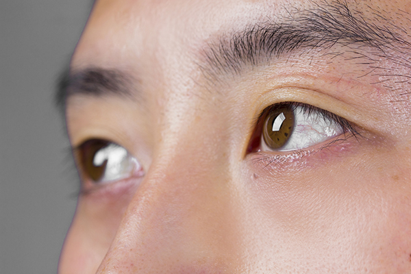 肝脏不好脸上图片,肝脏不好在脸上的表现