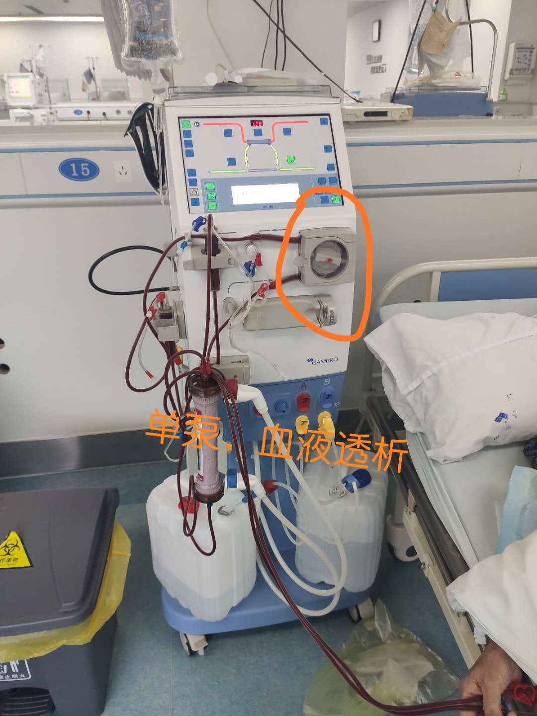 尿毒症透析患者冬季为什么受罪,尿毒症患者透析前一天呼吸困难