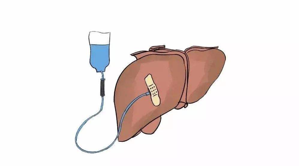 口服二甲双胍的副作用和禁忌,服用二甲双胍要注意的事项