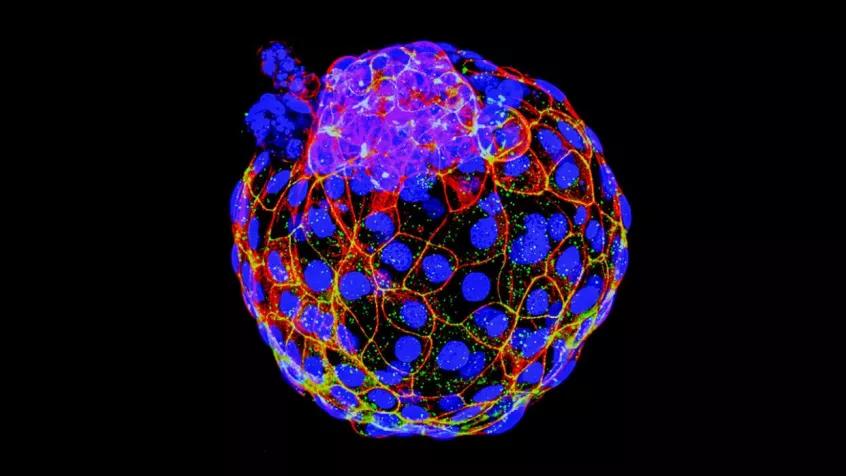 为何不孕流产?人类囊胚模型或许能解答