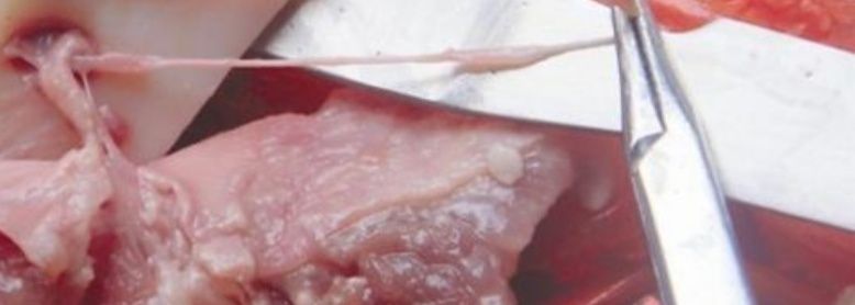 杀年猪吃的啥,杀年猪哪个部位肉最好吃