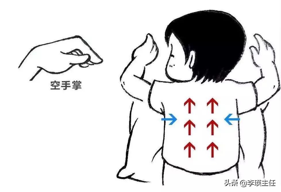 小宝宝痰怎么弄出来,小宝宝的痰是什么样子