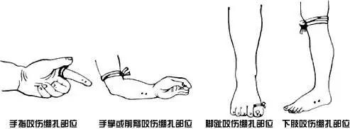 家附近蛇多怎么预防蛇不进屋,有蛇出没的地方怎么预防