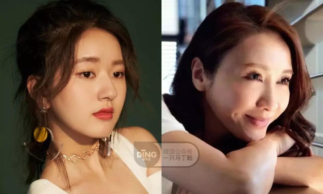 颧弓高脸型怎么改善,有泪沟可以通过调整脸型改善嘛