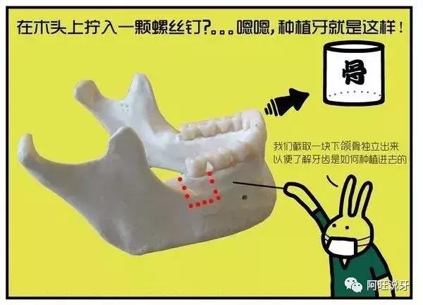 种植牙图片漫画,3d动画2分钟全面了解种植牙全过程