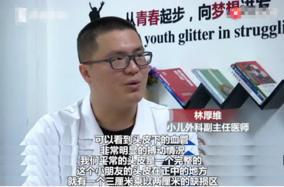 新生儿罕见现象,新生儿天生头皮缺失