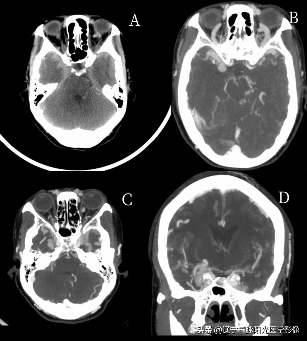 眼部疾病诊断有哪些,眼部病变有哪些症状