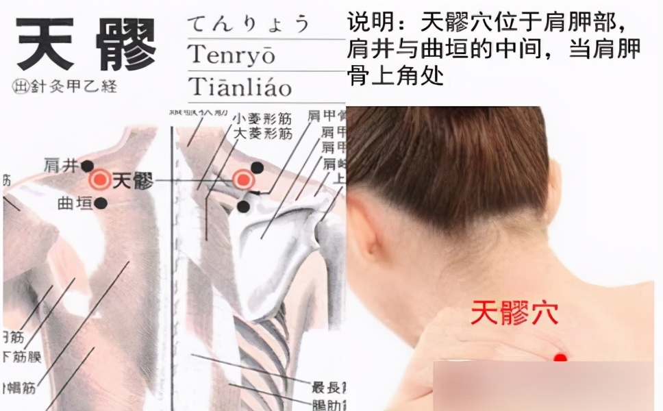 远端腱鞘炎,右手指腱鞘炎最快治疗方法