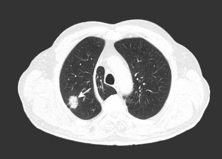 新冠病毒感染肺炎疫情防控知识,抗击新冠病毒肺炎
