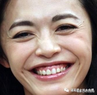 脸上的法令纹越来越深是什么原因,法令纹太明显怎么改善小技巧