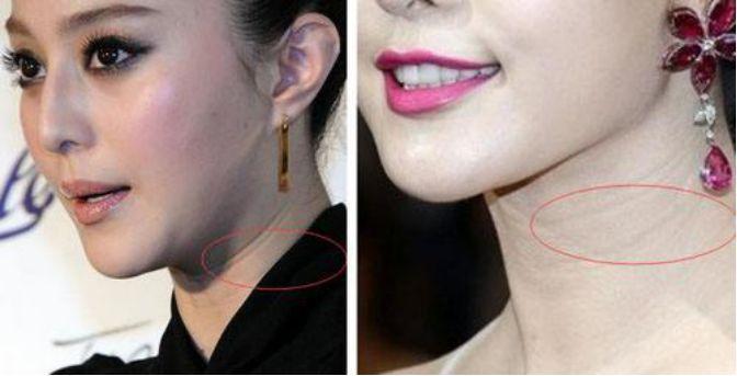 脸上哪个部位会让人看起来显老,脸上有这些特点的女生真的很显老