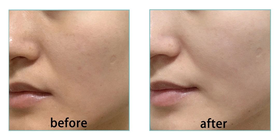 美白单靠防晒可以吗,美白靠bb霜就够了吗