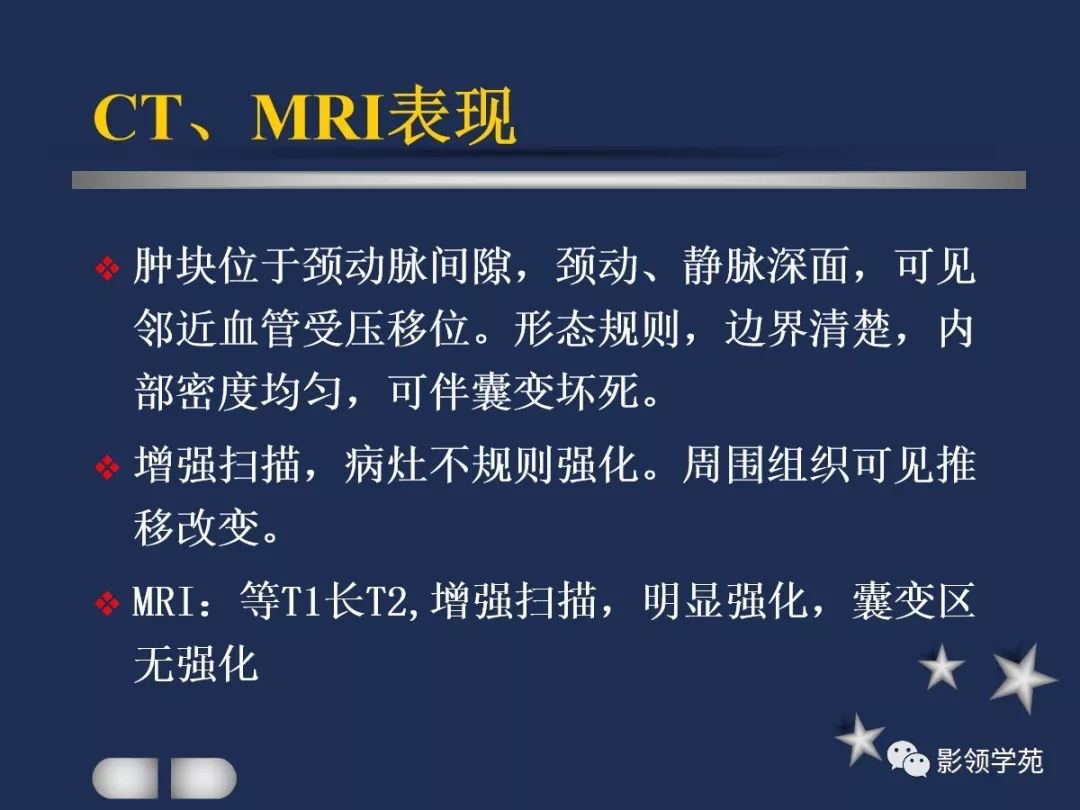 腮腺疾病影像学诊断,腮腺肿块影像诊断