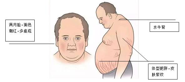 接触性皮炎和肝脏有没有关系,接触性皮炎不治疗会扩大吗