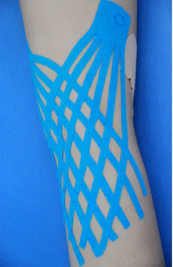 弹性贴布的原理,弹性贴布的作用