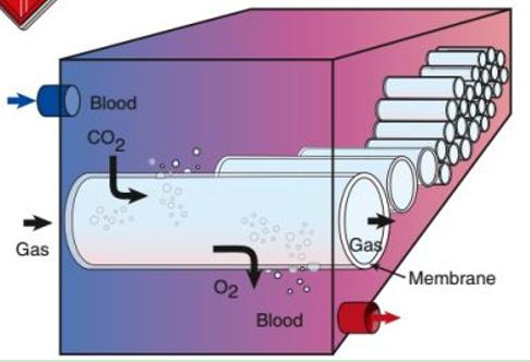 中国呼吸机国外供不应求,中国呼吸机现状