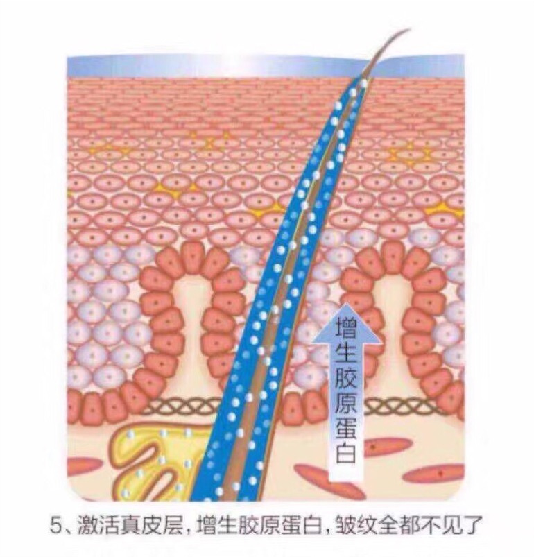 张庭活酵母面膜靠谱吗,张庭用了24年的活酵母
