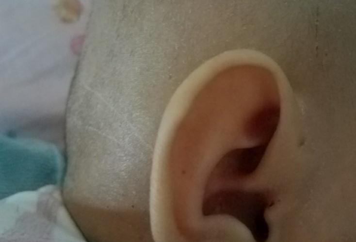 耳仓的危害,耳仓有什么危害