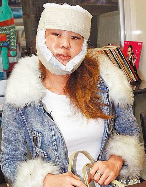 掌掴林心如,爱马仕当垃圾袋,我们每买一件阿迪都是给她送钱