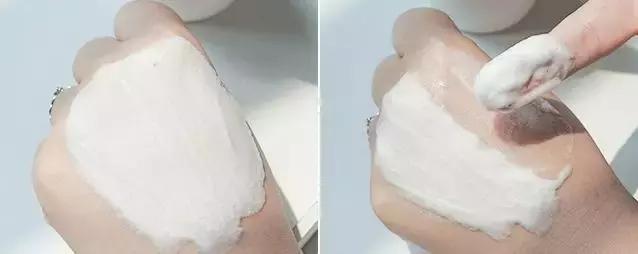 泛红期的红血丝怎么治疗,泛红的红血丝几天能好