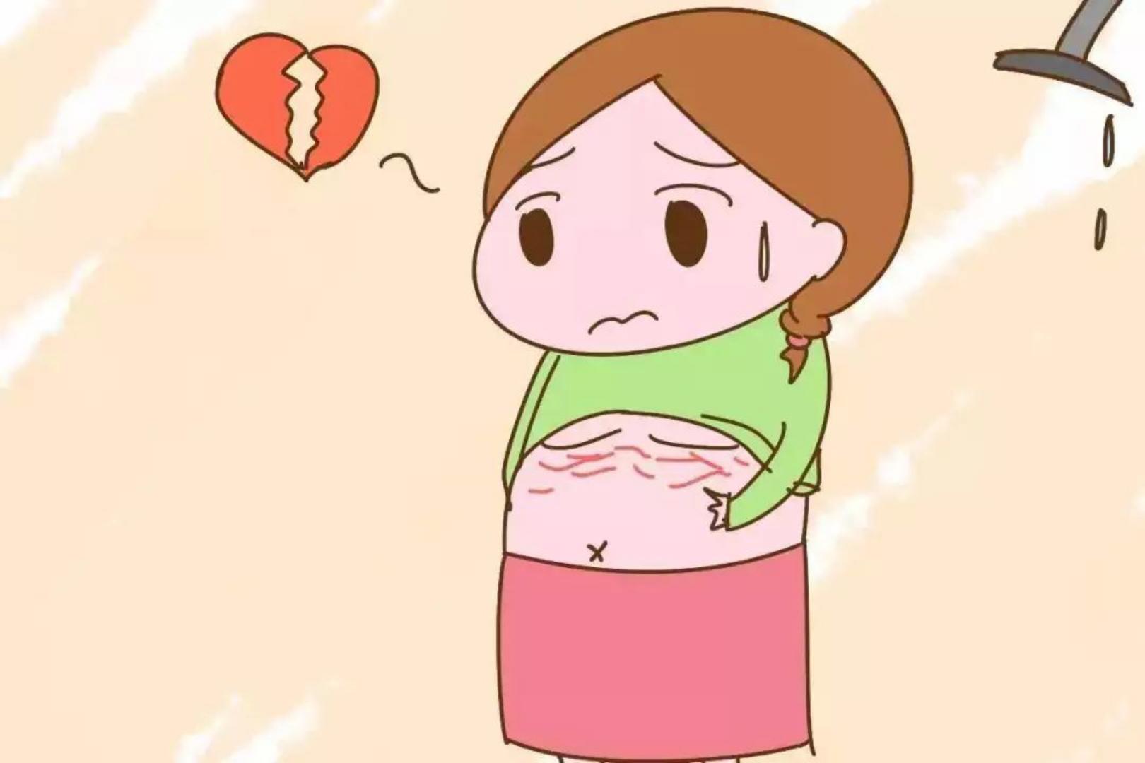 怀孕长妊娠纹肚皮痒怎么回事,孕早期肚皮痒是不是要长妊娠纹