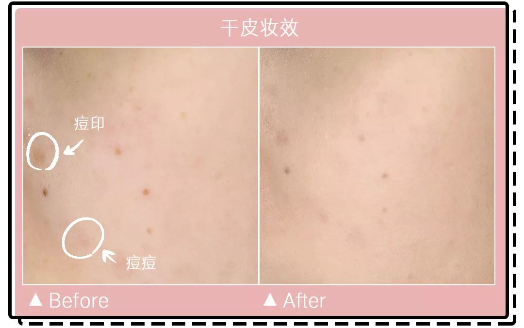 十大公认好用的混油皮粉底液排名,珀莱雅粉底液适合干皮还是油皮