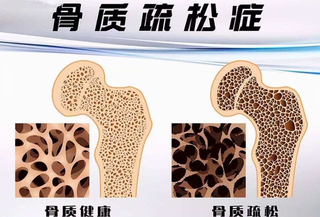 月经即将来的预兆,月经消失前或有3个信号