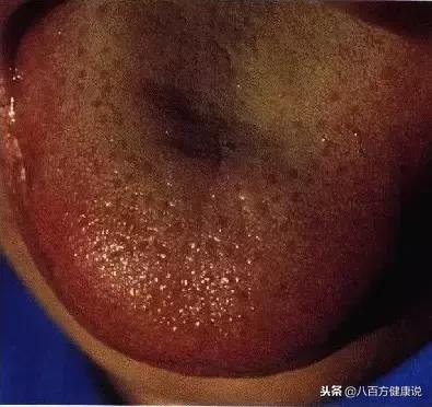 西洋参吃多了有副作用,西洋参吃多了会怎样