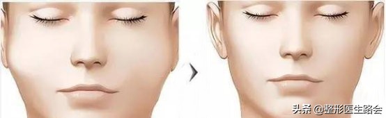 准备做手术应该问医生哪些问题,想做双眼皮先了解术前准备