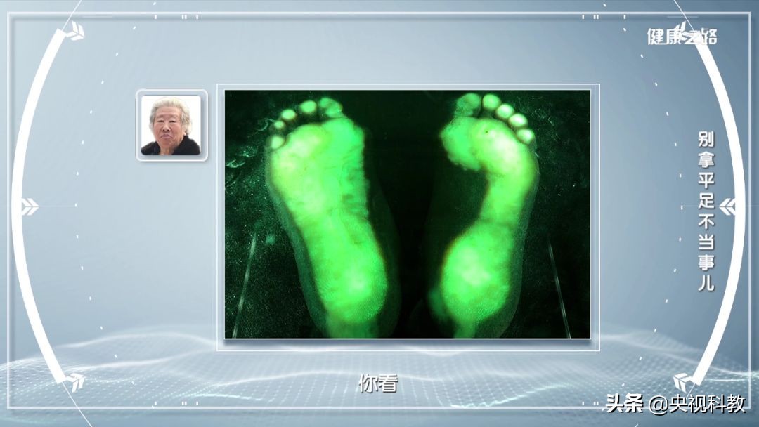 腰疼引起腿和脚麻是怎么回事,经常腰痛原来是脚的问题