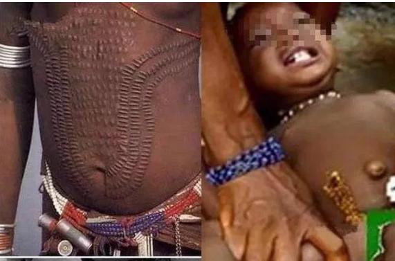熨平少女胸部!揭秘非洲可怕习俗“烫乳”