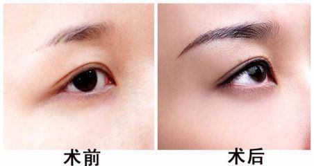 半永久纹眉是绣眉吗图片,植眉纹眉绣眉区别
